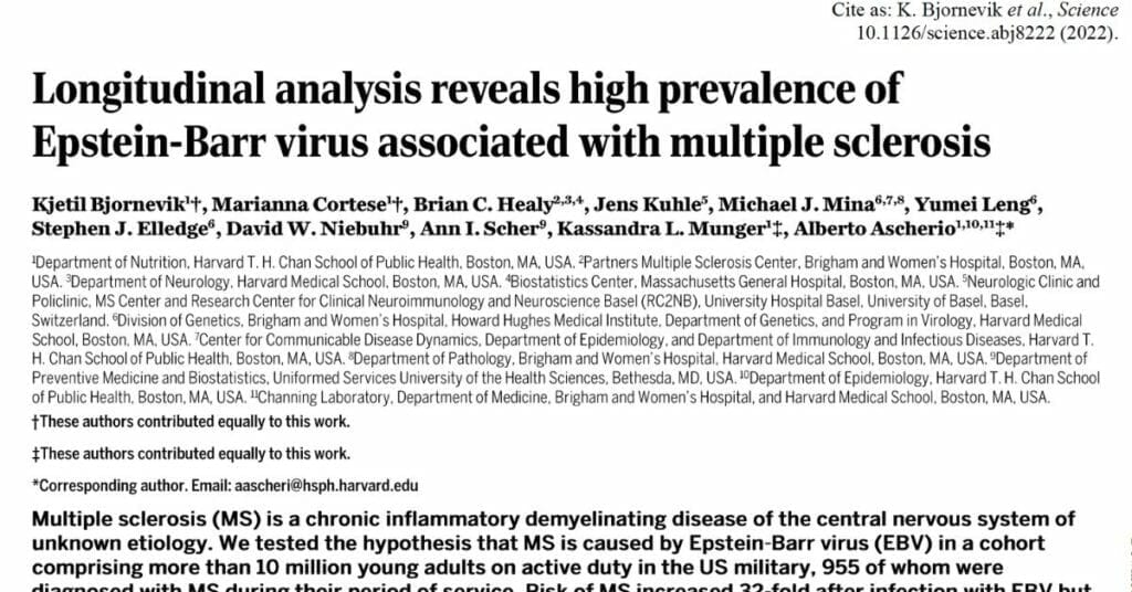 epstein barr virus MS